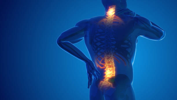 back pain explained